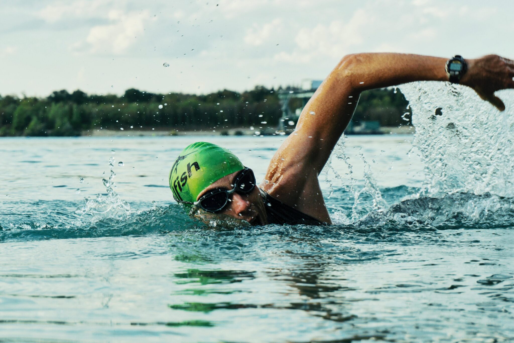 Swimming Injuries Turramurra Sports and Spinal Physiotherapy to